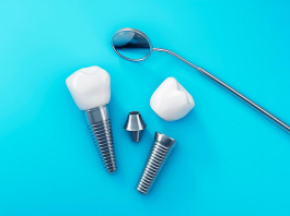 Langfristige Lösungen für funktionale und ästhetische Zähne Langfristige